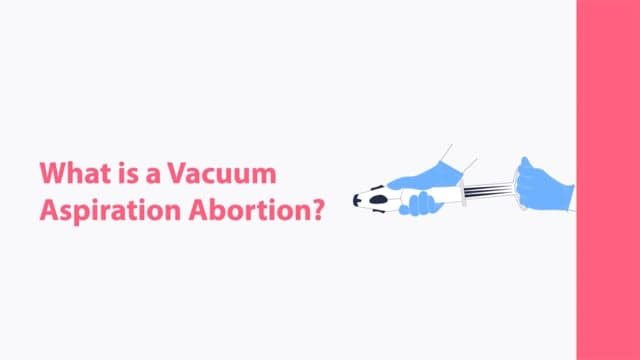 Manual Vacuum Aspiration Abortion